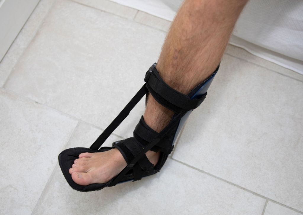 dropfoot syndrome orthopedic support