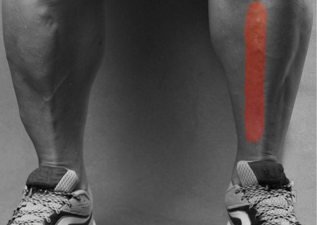 tibial fracture recovery