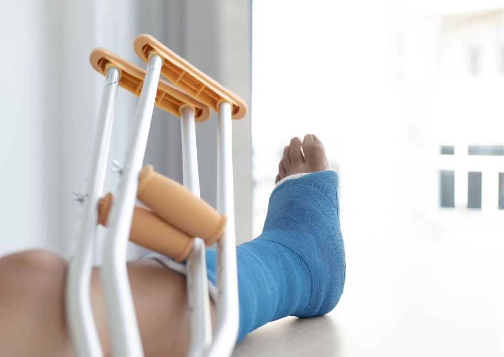 non-union fractures